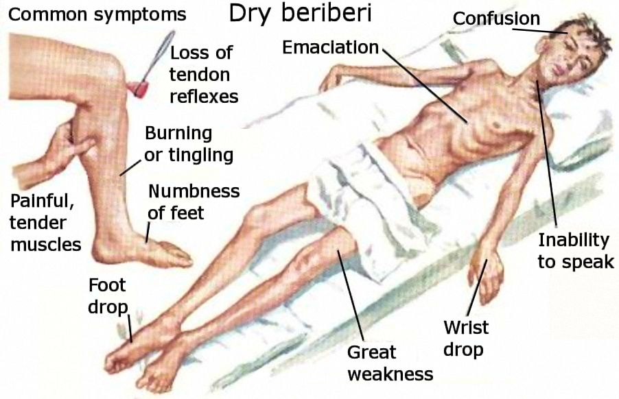 B1